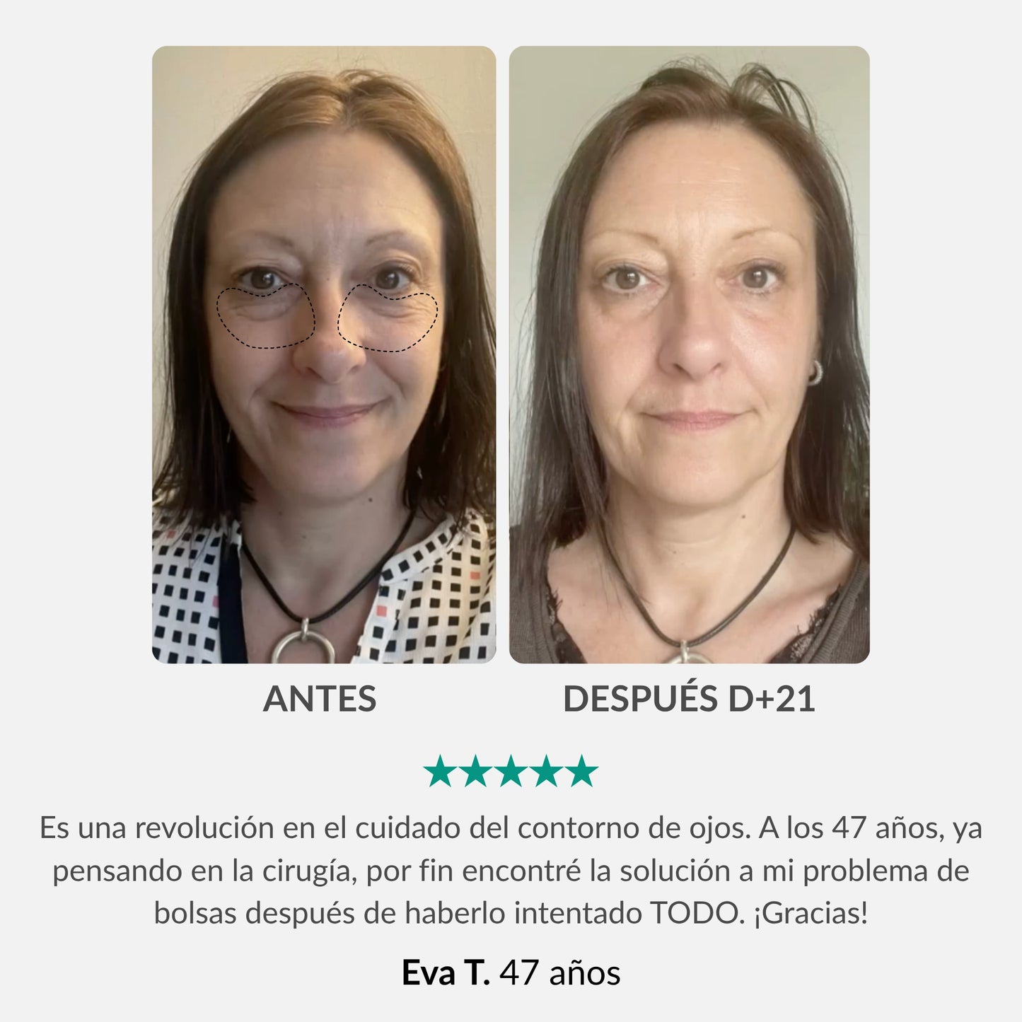 Helhetsbehandling för ögonkontur: Penna & aktiverande serum