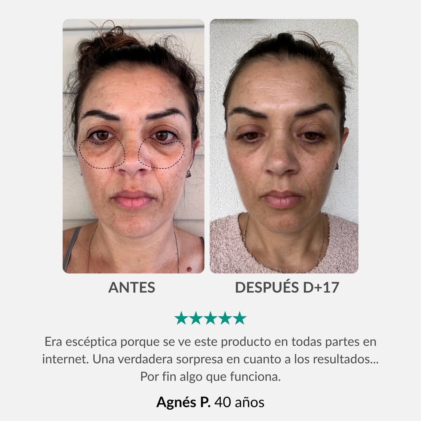 Helhetsbehandling för ögonkontur: Penna & aktiverande serum