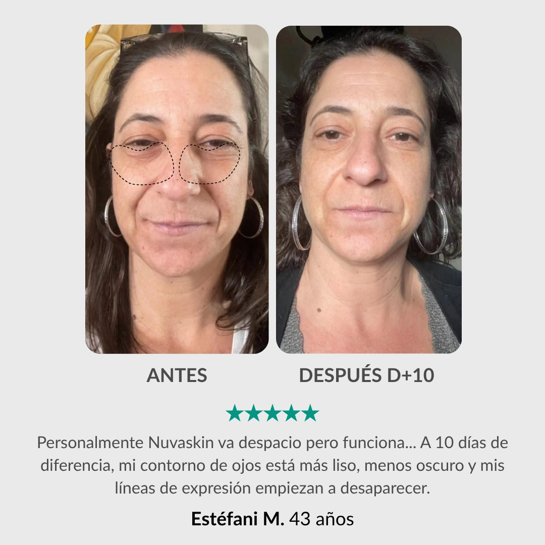 Helhetsbehandling för ögonkontur: Penna & aktiverande serum