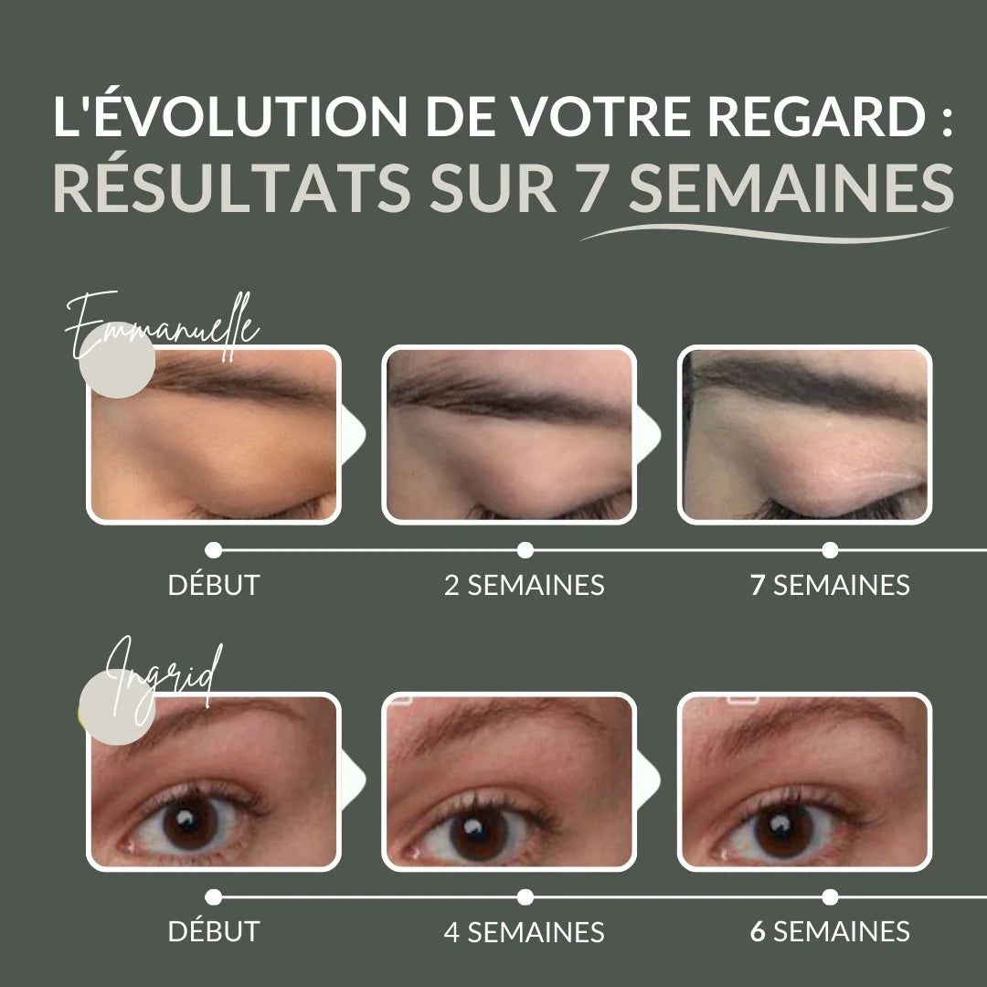 [DE]